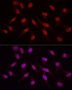 Immunofluorescence analysis of HeLa cells using Anti-WTAP Antibody (A305551) at a dilution of 1:50 (40x lens). DAPI was used to stain the cell nuclei (blue).