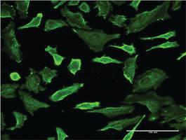 Anti-CDK16 Mouse Monoclonal Antibody [clone: 2E5]