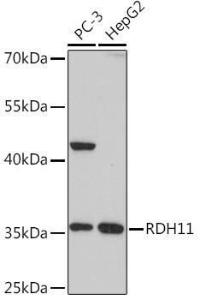 Western blot analysis of extracts of various cell lines, using Anti-RDH11 Antibody (A306506) at 1:1,000 dilution