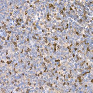 Immunohistochemistry analysis of paraffin-embedded human tonsil using Anti-LTBR Antibody (A11826) at a dilution of 1:20 (40X lens). Perform high pressure antigen retrieval with 10 mM citrate buffer pH 6.0 before commencing with IHC staining protocol