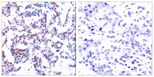 Antibody anti-JUNB phospho SER259 100 µg