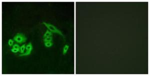 Antibody anti-GPR12 100 µg