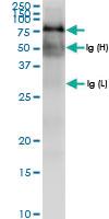 Anti-TRAP1 Rabbit Polyclonal Antibody