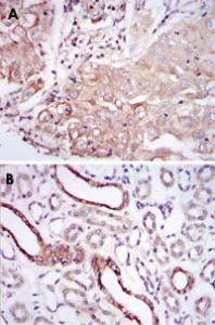 Anti-PODXL Mouse Monoclonal Antibody [clone: 5F5]