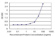 Anti-CA3 Antibody Pair