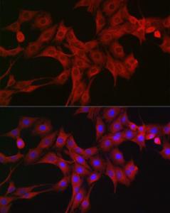 Immunofluorescence analysis of PC-12 cells using Anti-LTBR Antibody (A11826) at a dilution of 1:200 (40X lens). DAPI was used to stain the cell nuclei (blue)