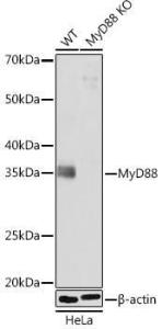 Western blot analysis of extracts from wild type (WT) and MyD88 knockout (KO) HeLa cells, using Anti-MyD88 Antibody [ARC52507] (A306508) at 1:1000 dilution. The secondary Antibody was Goat Anti-Rabbit IgG H&L Antibody (HRP) at 1:10000 dilution