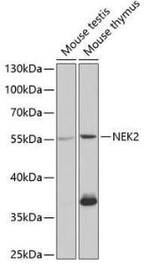 Western blot analysis of extracts of various cell lines, using Anti-NEK2 Antibody (A11827) at 1:1000 dilution. The secondary Antibody was Goat Anti-Rabbit IgG H&L Antibody (HRP) at 1:10000 dilution. Lysates/proteins were present at 25 µg per lane