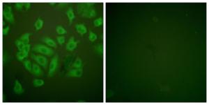 Antibody anti-stefin A 100 µg