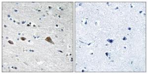 Immunohistochemical analysis of paraffin-embedded human brain tissue using Anti-BCAR3 Antibody. The right hand panel represents a negative control, where the Antibody was pre-incubated with the immunising peptide