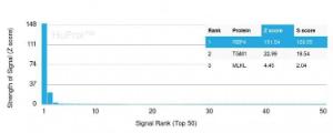 Analysis of protein array containing more than 19000 full-length human proteins using Anti-RBP4 Antibody [RBP4/4045]