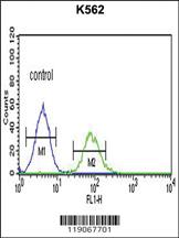 Anti-CHEK2 Rabbit Polyclonal Antibody