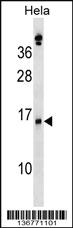 Anti-SLPI Rabbit Polyclonal Antibody