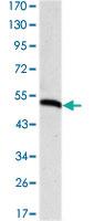 Anti-PODXL Mouse Monoclonal Antibody [clone: 5F5]