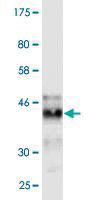 Anti-IFITM3 Mouse Monoclonal Antibody [clone: 2H4-1D5]