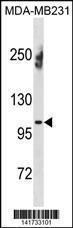 Anti-ENPP1 Rabbit Polyclonal Antibody (Biotin)