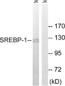 Antibody anti-SREBP-1 100 µg