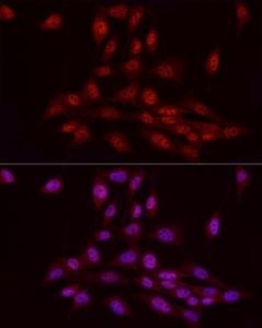 Immunofluorescence analysis of NIH/3T3 cells using Anti-WTAP Antibody (A305551) at a dilution of 1:50 (40x lens). DAPI was used to stain the cell nuclei (blue).