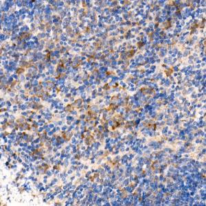 Immunohistochemistry analysis of paraffin-embedded mouse spleen using Anti-MyD88 Antibody [ARC52507] (A306508) at a dilution of 1:1000 (40X lens). Perform high pressure antigen retrieval with 10 mM citrate buffer pH 6.0 before commencing with IHC staining protocol