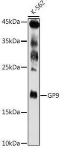 Western blot analysis of extracts of K-562 cells, using Anti-CD42a/GP-IX Antibody (A11828) at 1:500 dilution