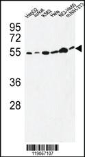 Anti-CHEK2 Rabbit Polyclonal Antibody