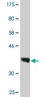 Anti-RPRD1A Mouse Monoclonal Antibody [clone: 1B9]