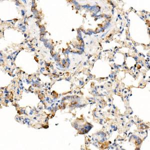 Immunohistochemistry analysis of paraffin-embedded rat lung using Anti-MyD88 Antibody [ARC52507] (A306508) at a dilution of 1:1000 (40X lens). Perform high pressure antigen retrieval with 10 mM citrate buffer pH 6.0 before commencing with IHC staining protocol