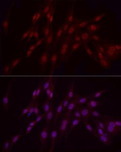 Immunofluorescence analysis of PC-12 cells using Anti-WTAP Antibody (A305551) at a dilution of 1:50 (40x lens). DAPI was used to stain the cell nuclei (blue).