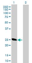 Anti-BCAP29 Mouse Polyclonal Antibody