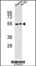 Anti-Nuclear Receptor LXR beta Rabbit Polyclonal Antibody