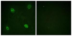 Immunofluorescence analysis of HeLa cells using Anti-hnRPD (phospho Ser83) Antibody The right hand panel represents a negative control, where the antibody was pre-incubated with the immunising peptide