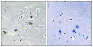 Antibody anti-SREBP-1 100 µg