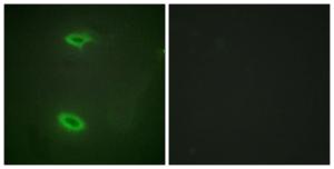 Immunofluorescence analysis of HeLa cells using Anti-DLGP1 Antibody. The right hand panel represents a negative control, where the antibody was pre-incubated with the immunising peptide.