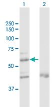 Anti-ZNF92 Rabbit Polyclonal Antibody