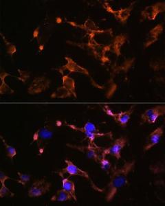 Immunofluorescence analysis of U-251 MG cells using Anti-Amphiphysin Antibody (A11829) at a dilution of 1:100 (40x lens). DAPI was used to stain the cell nuclei (blue).