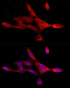 Immunofluorescence analysis of U-87MG cells using Anti-MIF Antibody (A309405) at a dilution of 1:50 (40x lens). DAPI was used to stain the cell nuclei (blue).