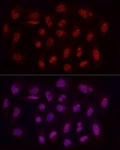 Immunofluorescence analysis of U2OS cells using Anti-WTAP Antibody (A305551) at a dilution of 1:50 (40x lens). DAPI was used to stain the cell nuclei (blue).