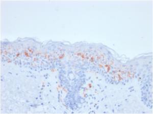 Immunohistochemical analysis of formalin-fixed, paraffin-embedded human skin using Anti-CD1a Antibody [rC1A/711]