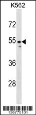 Anti-PAX2 Rabbit Polyclonal Antibody