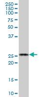 Anti-BCAP29 Mouse Polyclonal Antibody