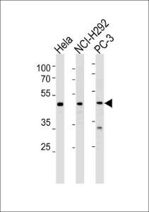 Anti-NR0B1 Rabbit Polyclonal Antibody (AP (Alkaline Phosphatase))