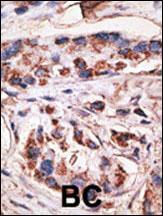 Anti-MAGEA1 Rabbit Polyclonal Antibody (AP (Alkaline Phosphatase))