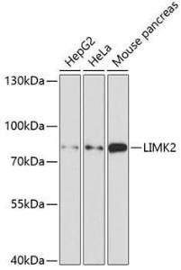 Western blot analysis of extracts of various cell lines, using Anti-LIMK2 Antibody (A11830) at 1:1,000 dilution. The secondary antibody was Goat Anti-Rabbit IgG H&L Antibody (HRP) at 1:10,000 dilution.