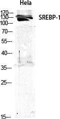 Antibody anti-SREBP-1 100 µg