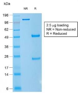 SDS-PAGE analysis of Anti-CD1a Antibody [rC1A/711] under non-reduced and reduced conditions; showing intact IgG and intact heavy and light chains, respectively. SDS-PAGE analysis confirms the integrity and purity of the antibody