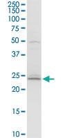 Anti-BCAP29 Rabbit Polyclonal Antibody