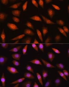 Immunofluorescence analysis of L929 cells using Anti-LIMK2 Antibody (A11830) at a dilution of 1:100 (40x lens). DAPI was used to stain the cell nuclei (blue).