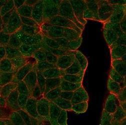 Immunofluorescent analysis of PFA-fixed MCF-7 cells stained with Anti-BCL11A Antibody [PCRP-BCL11A-1H3] followed by Goat Anti-Mouse IgG (CFand#174; 488) (Green). CFand#174; 640A Phalloidin (Red)