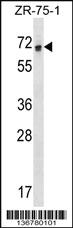 Anti-RCOR1 Rabbit Polyclonal Antibody