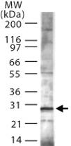 Anti-TP53INP1 Rabbit Polyclonal Antibody